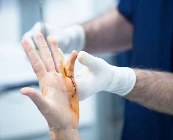 Orthopedic Oncology